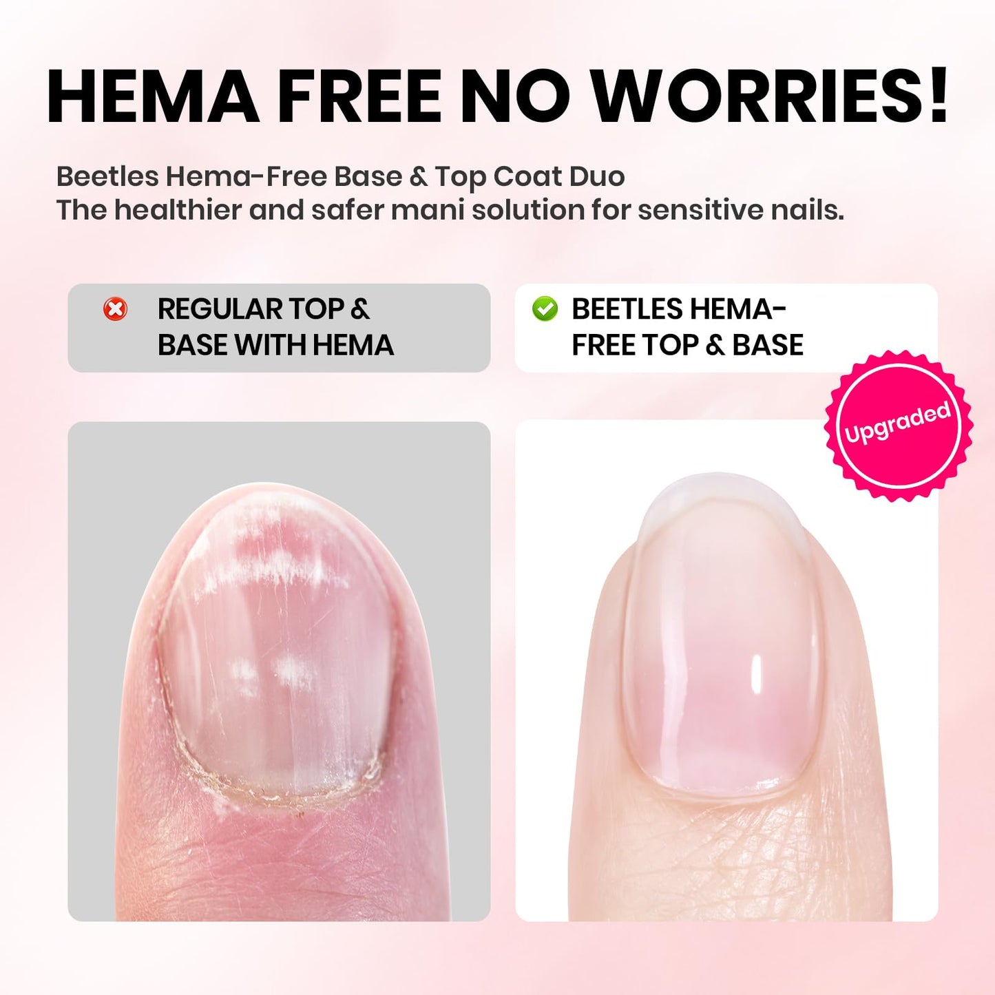 Beetles 2 Pcs 15ml No Wipe Gel Top Coat and Base Coat Set - Shine Finish and Long Lasting, Soak Off LED Nail Lamp Gel Base Top Coat Finish Nail Art Design Manicure